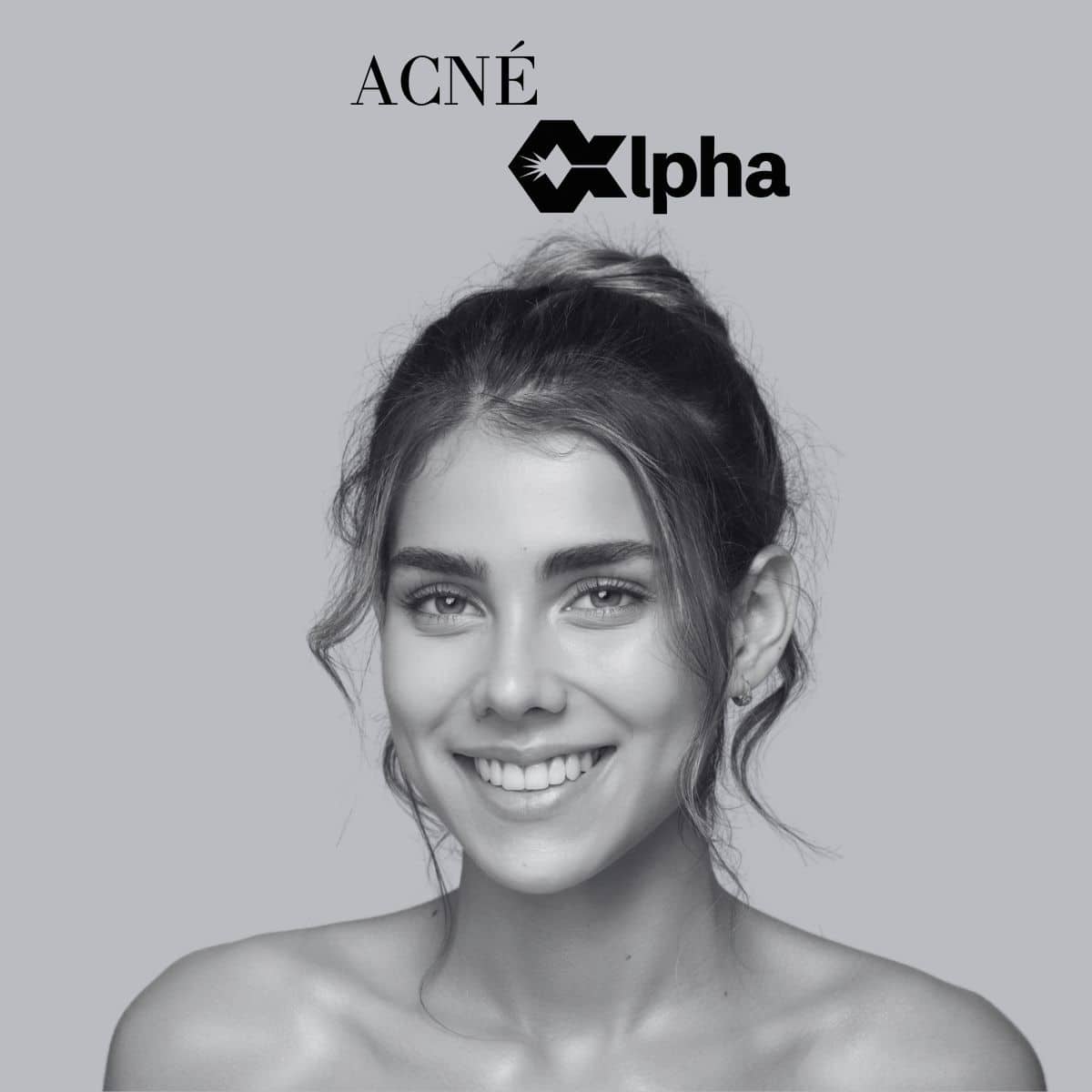 Acné
