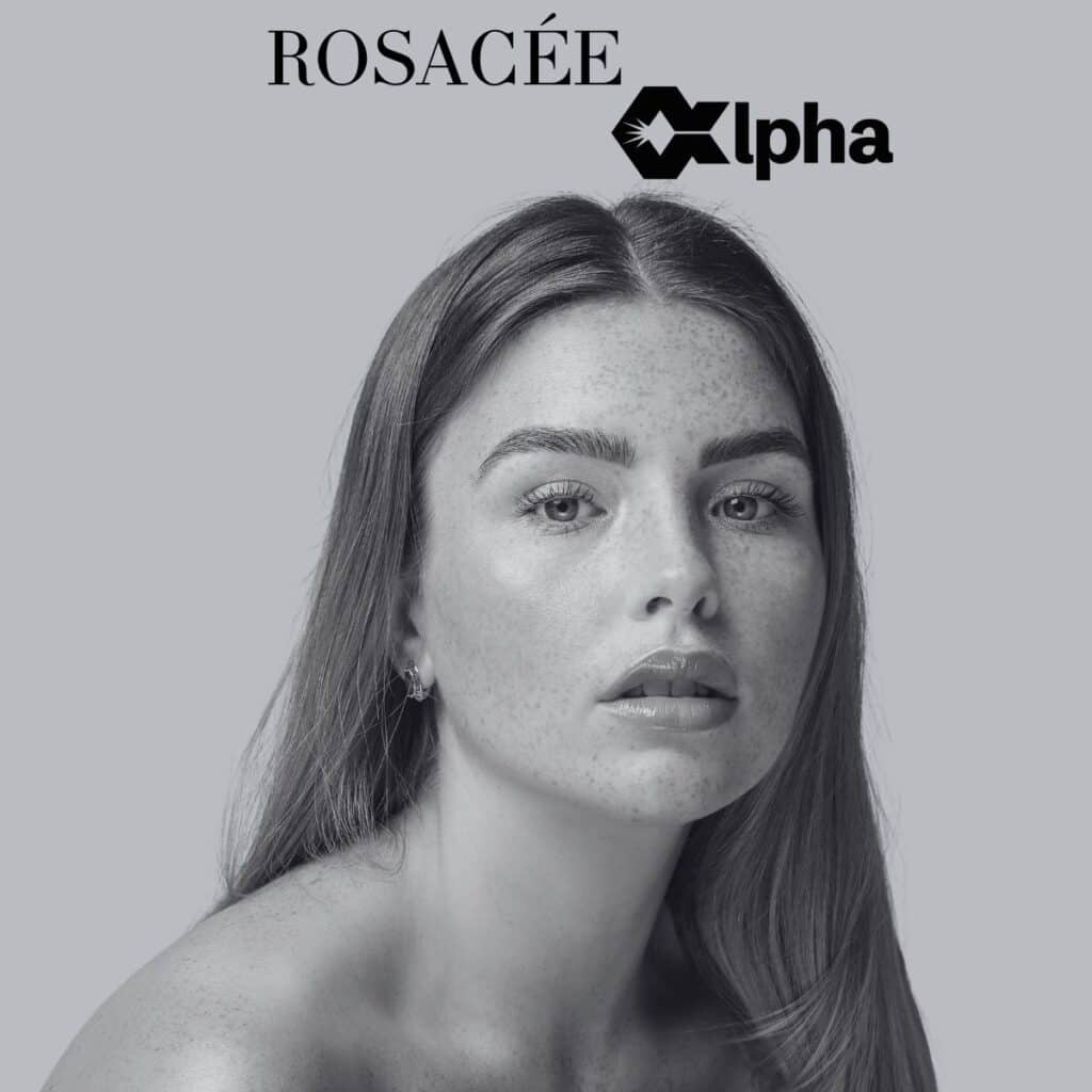 Jolie visage de femme et représente l'égérie des traitements rosacee avec Alpha.