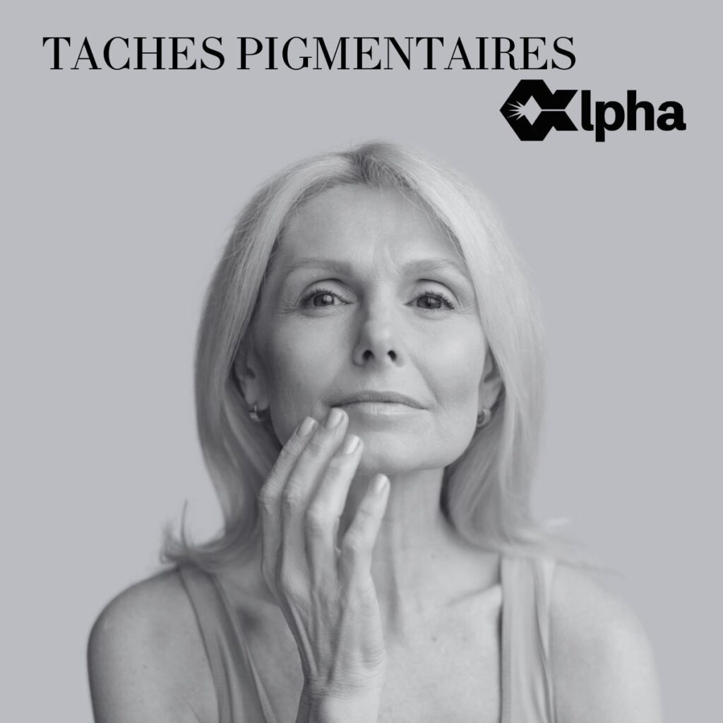 Jolie visage de femme et égérie représente l'égérie des taches pigmentaires avec Alpha.