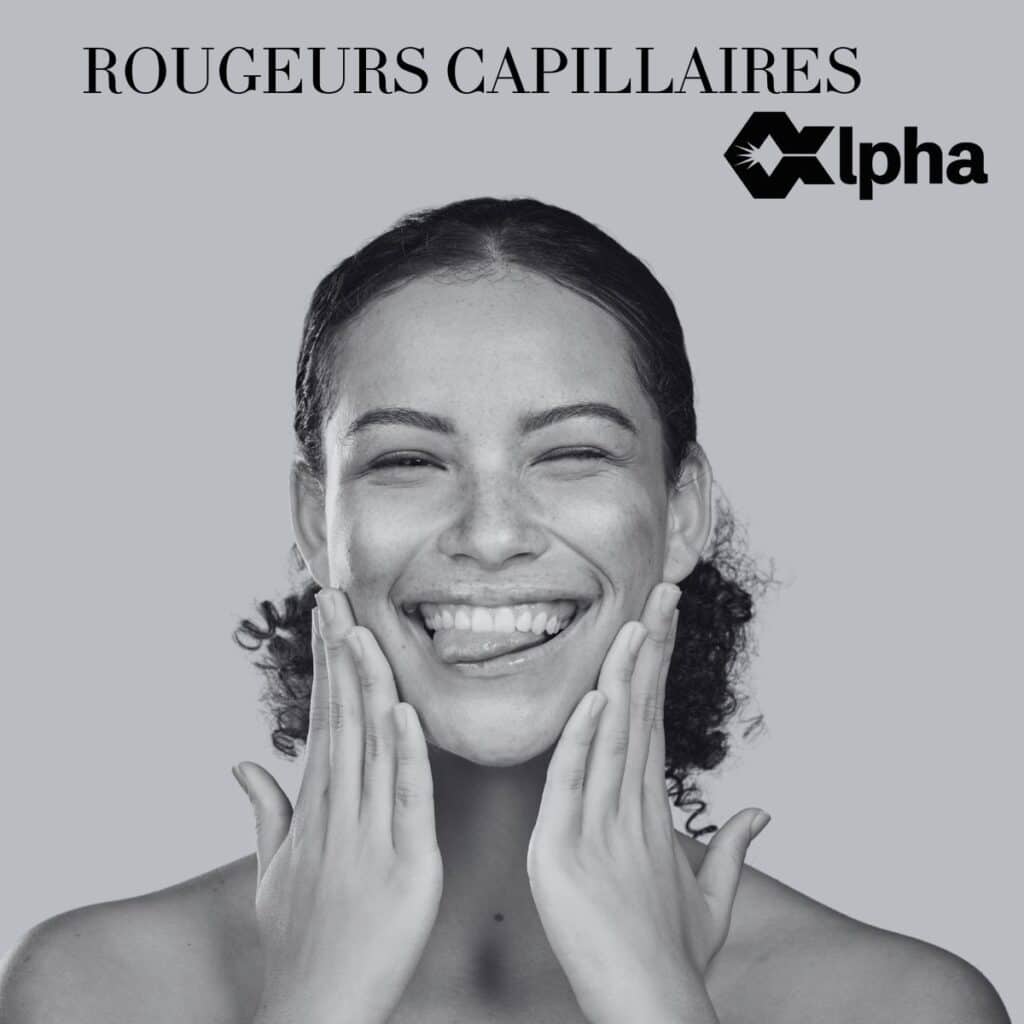 ROUGEURS CAPILLAIRES ALPHA