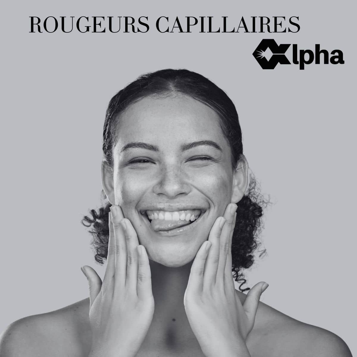 Rougeurs capillaires